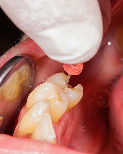 Endodoncia