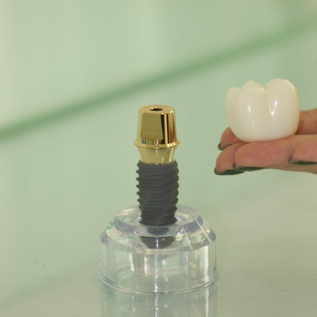 Implantes Dentales