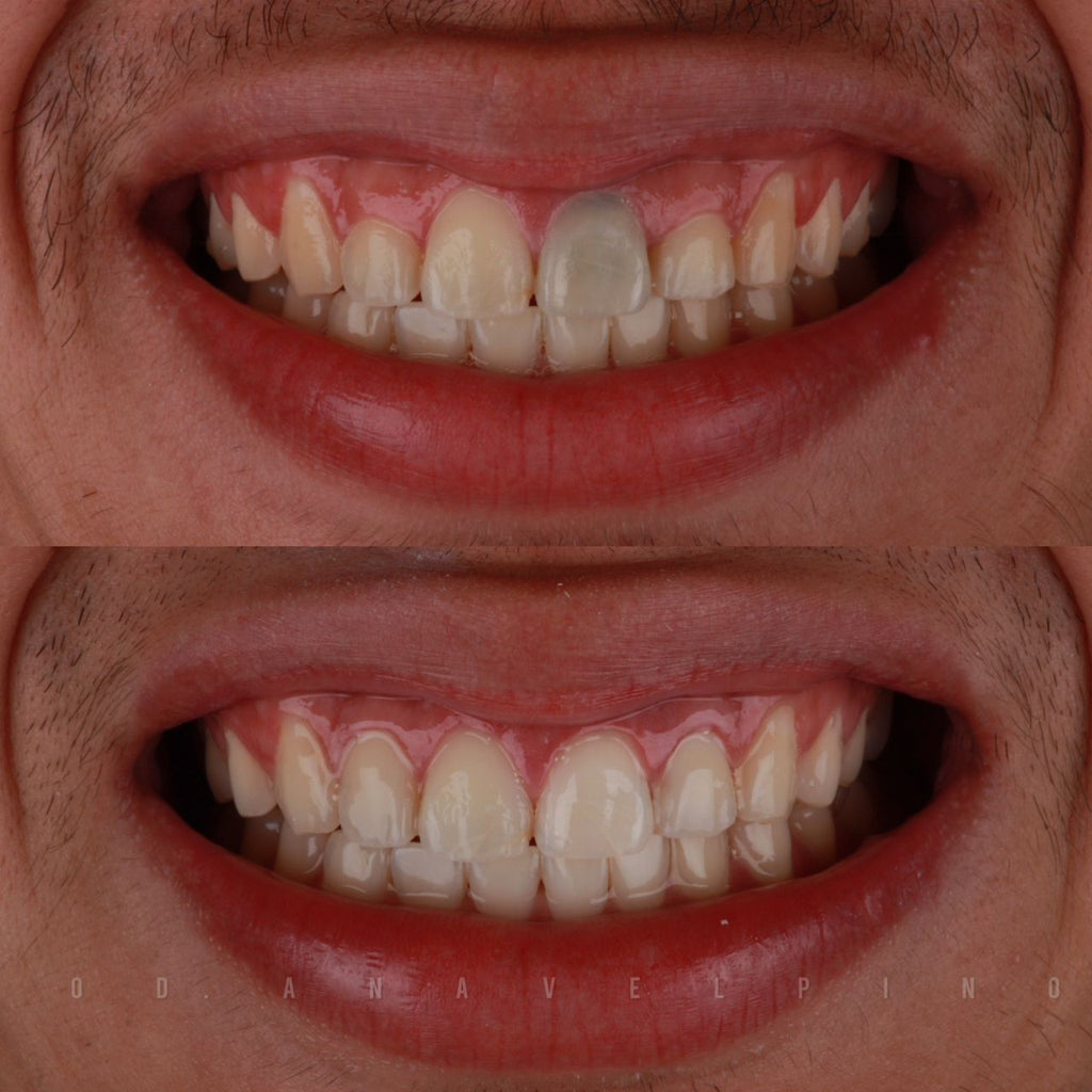 Estética Dental