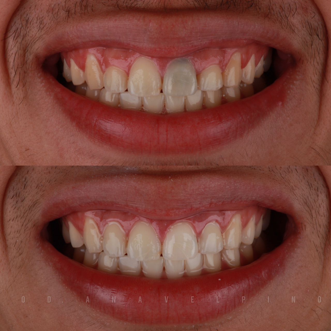 Estética Dental
