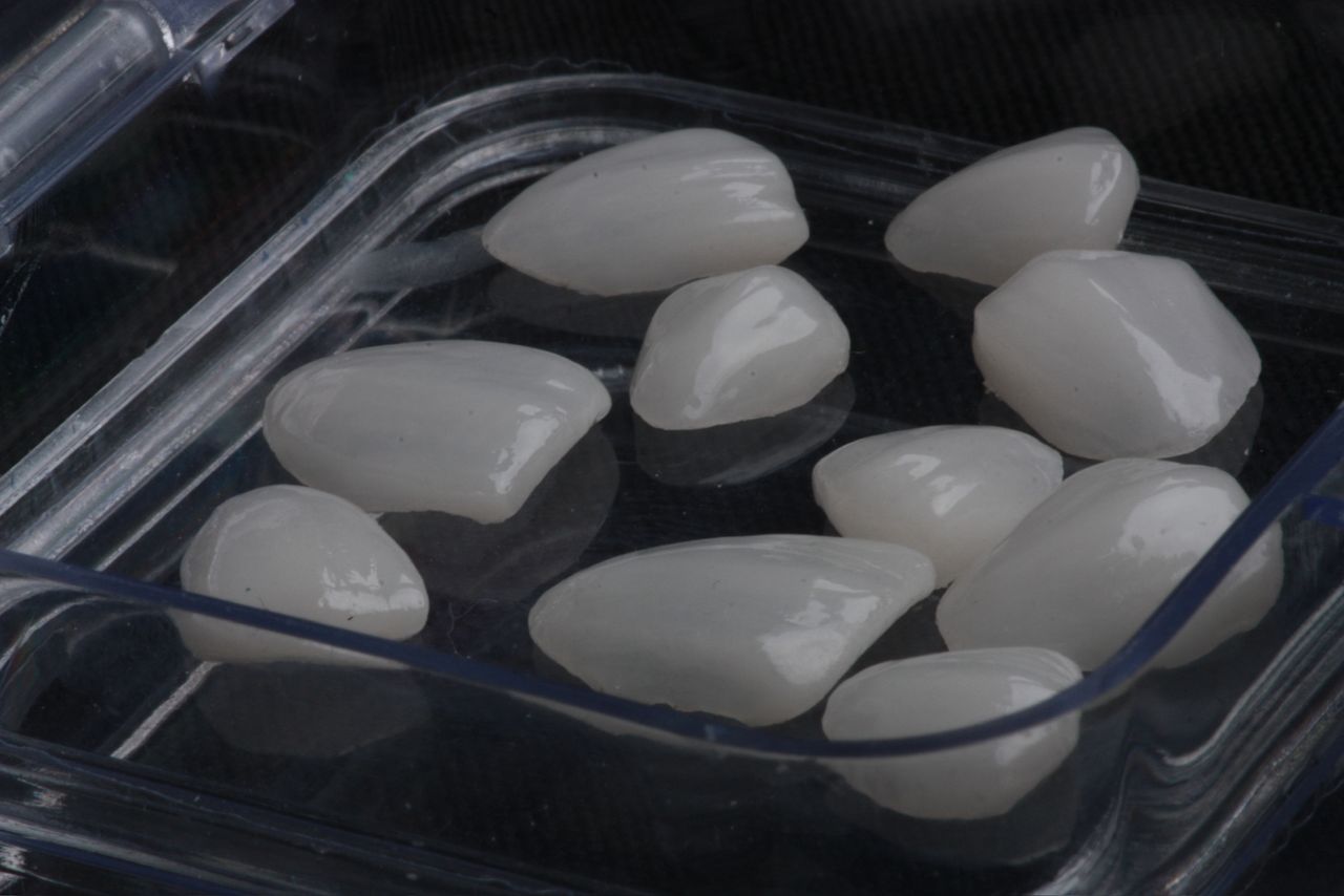 Estética Dental