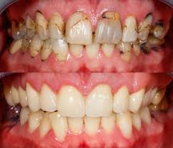 Rehabilitación Oral