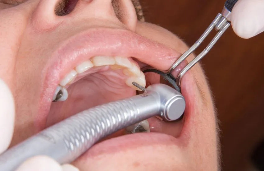 Rehabilitación Oral