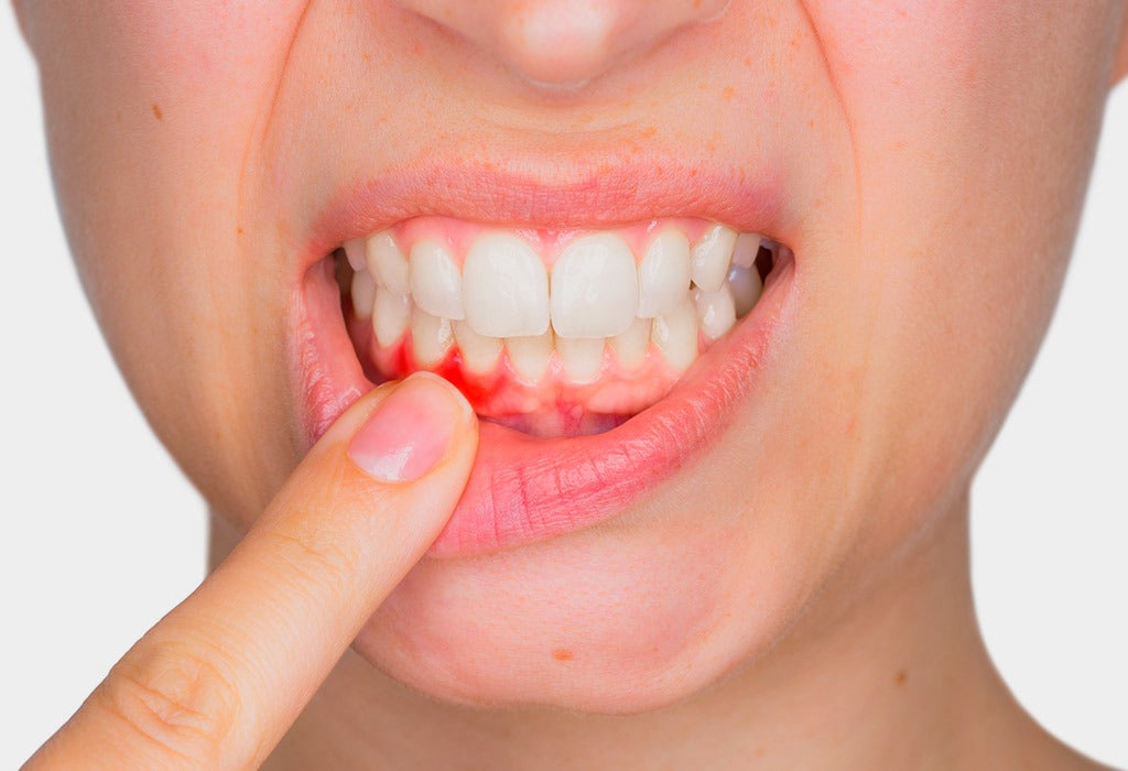 Periodoncia